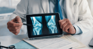 A digital X-ray of a knee joint on a tablet with the radiologist pointing to it with a pen.