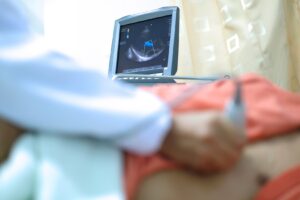 A medical professional performing an echocardiogram with the screen showing the readings.
