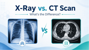 X-ray and CT scan comparison showing a chest X-ray beside a detailed cross-sectional CT image of the chest.