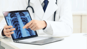 A radiologist pointing to a digital X-ray of ribs on a laptop.