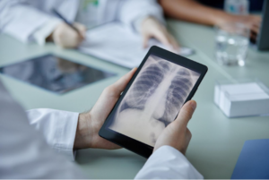 A healthcare provider holding a tablet with a digital X-ray of a patient’s chest and lungs.