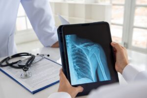 A radiologist showing a digital X-ray of a shoulder on a tablet to a patient. 