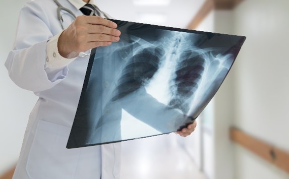 What to Expect During an X-ray Procedure | ImageCare Centers