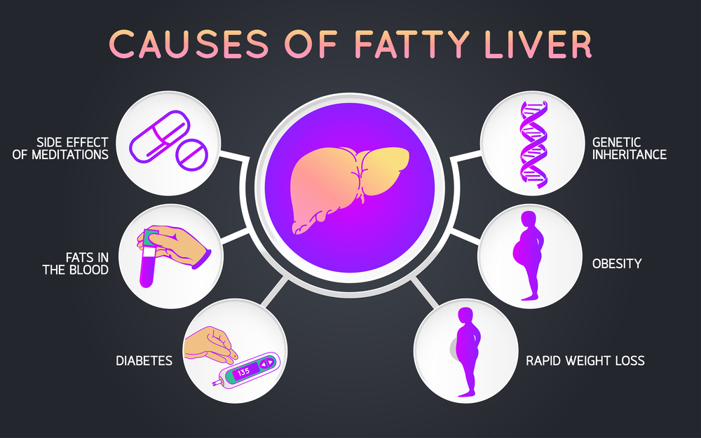 using-fibroscan-to-detect-liver-fibrosis-in-diabetic-patients