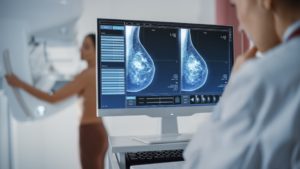 A picture of a radiologist looking at an x-ray during a woman’s mammogram screening.