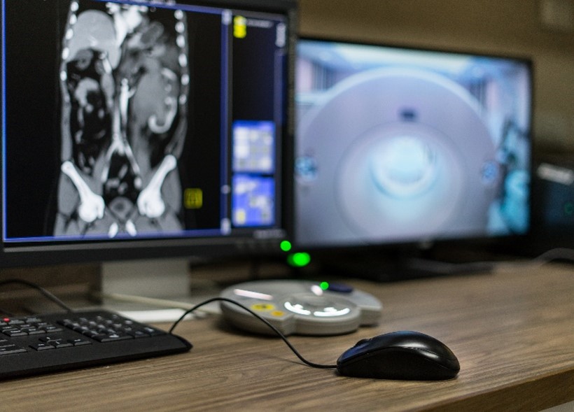 3 Things You Need to Know About a CT Urogram