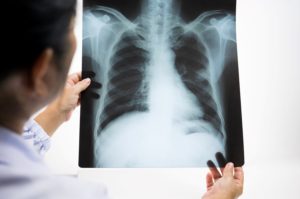 A Male Healthcare Professional Pictured from Behind His Shoulder Holds up and Looks at an X-ray of a Torso