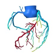 heart flow illustration