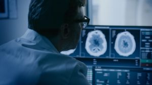 A Man Wearing a White Coat and Glasses Looking at a Screen Showing a Brain Scan