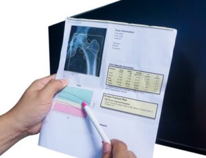 A hand holds a paper with imaging of a hip bone and DEXA scan data while the other hand points to the paper with a pen.