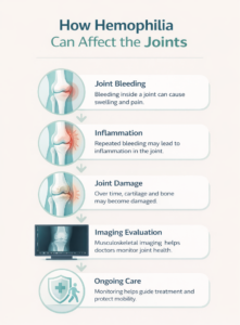 Infographic illustrating how hemophilia affects joints and how musculoskeletal imaging helps monitor joint health.