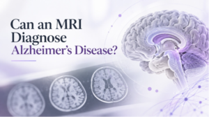 Brain MRI images illustrating how neuroradiology may support Alzheimer’s disease evaluation.