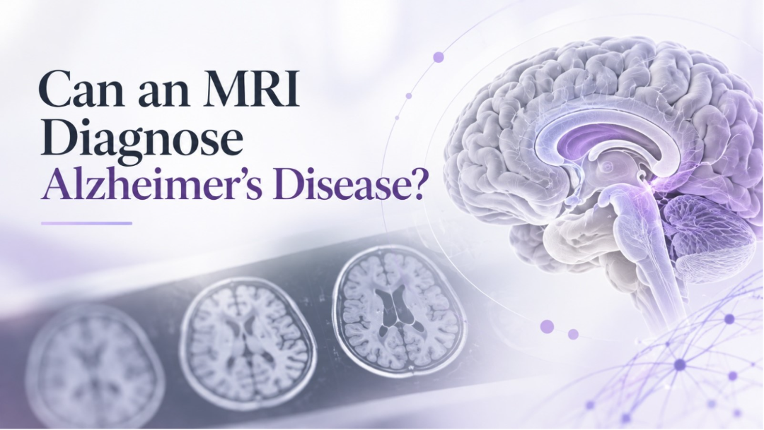 Can an MRI Diagnose Alzheimer’s Disease? | ImageCare Centers