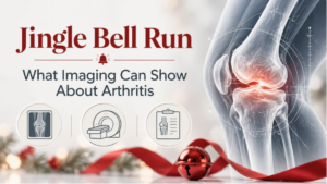 Knee imaging graphic illustrating how musculoskeletal imaging can help evaluate arthritis-related joint changes.